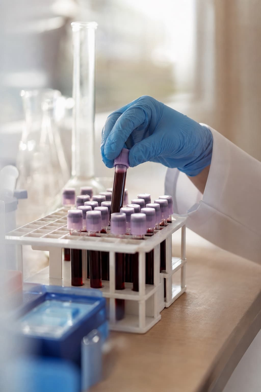 Gloved hand placing a blood collection tube into a rack